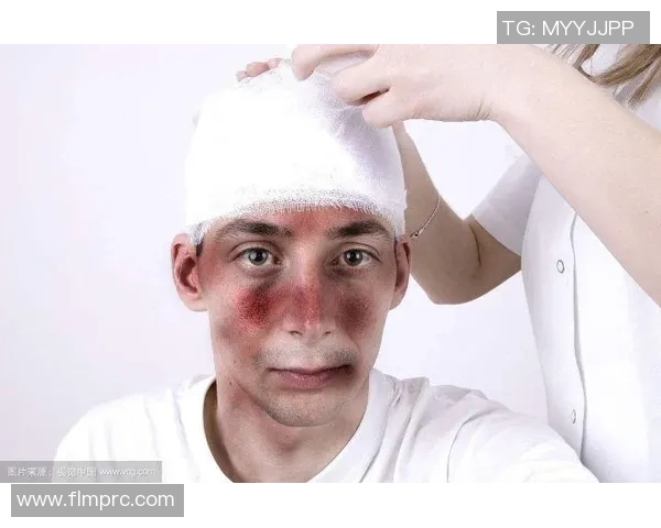 足球比赛中脸部受伤的风险分析与预防措施探讨